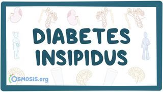 Video poster for Diabetes insipidus