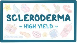 Video poster for High Yield: Scleroderma