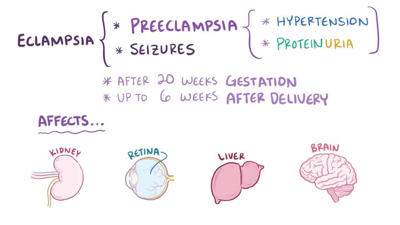video-preeclampsia-eclampsia