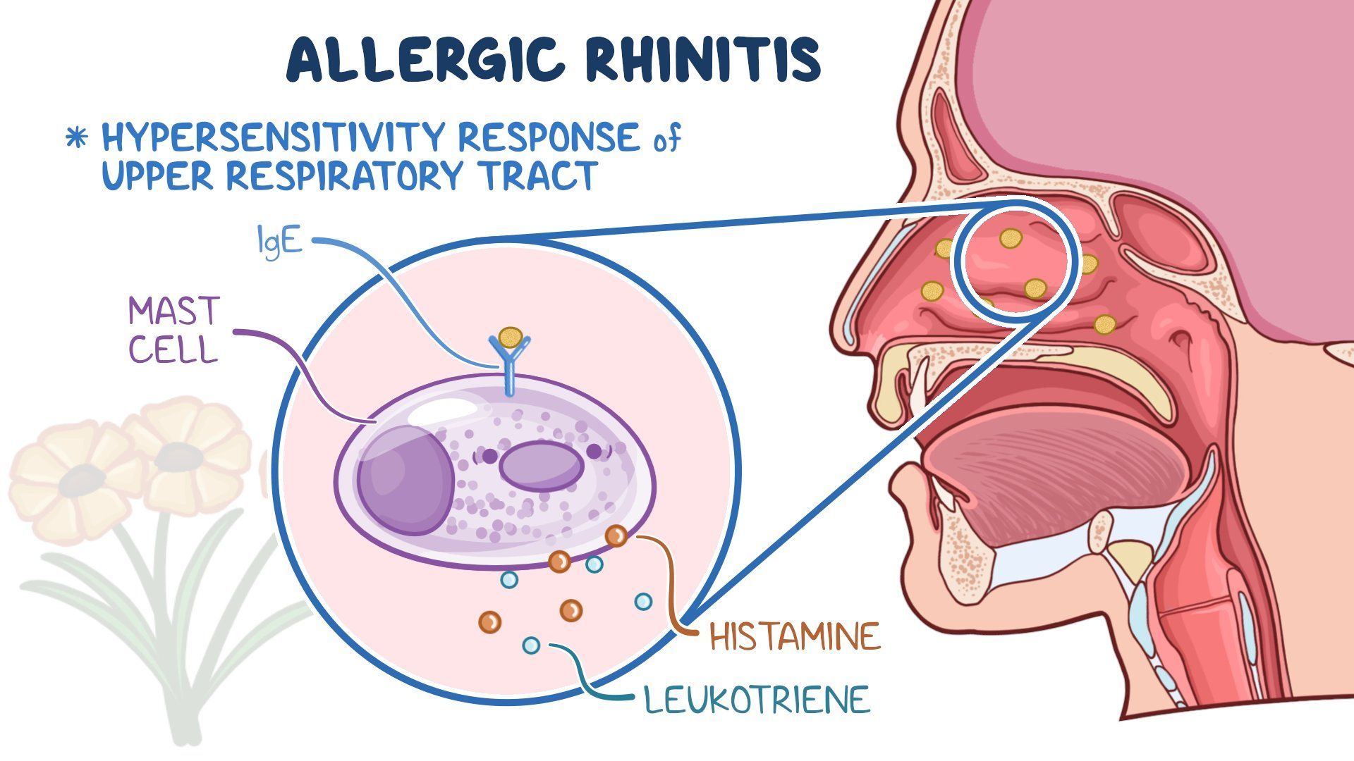 Video: Allergic rhinitis: Clinical sciences | Osmosis