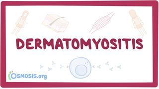 Video poster for Dermatomyositis