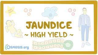 Video poster for High Yield: Jaundice