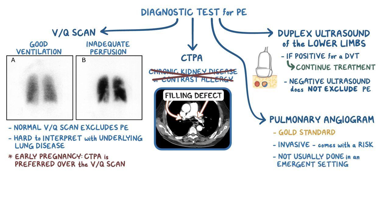 Ultrasound Gel