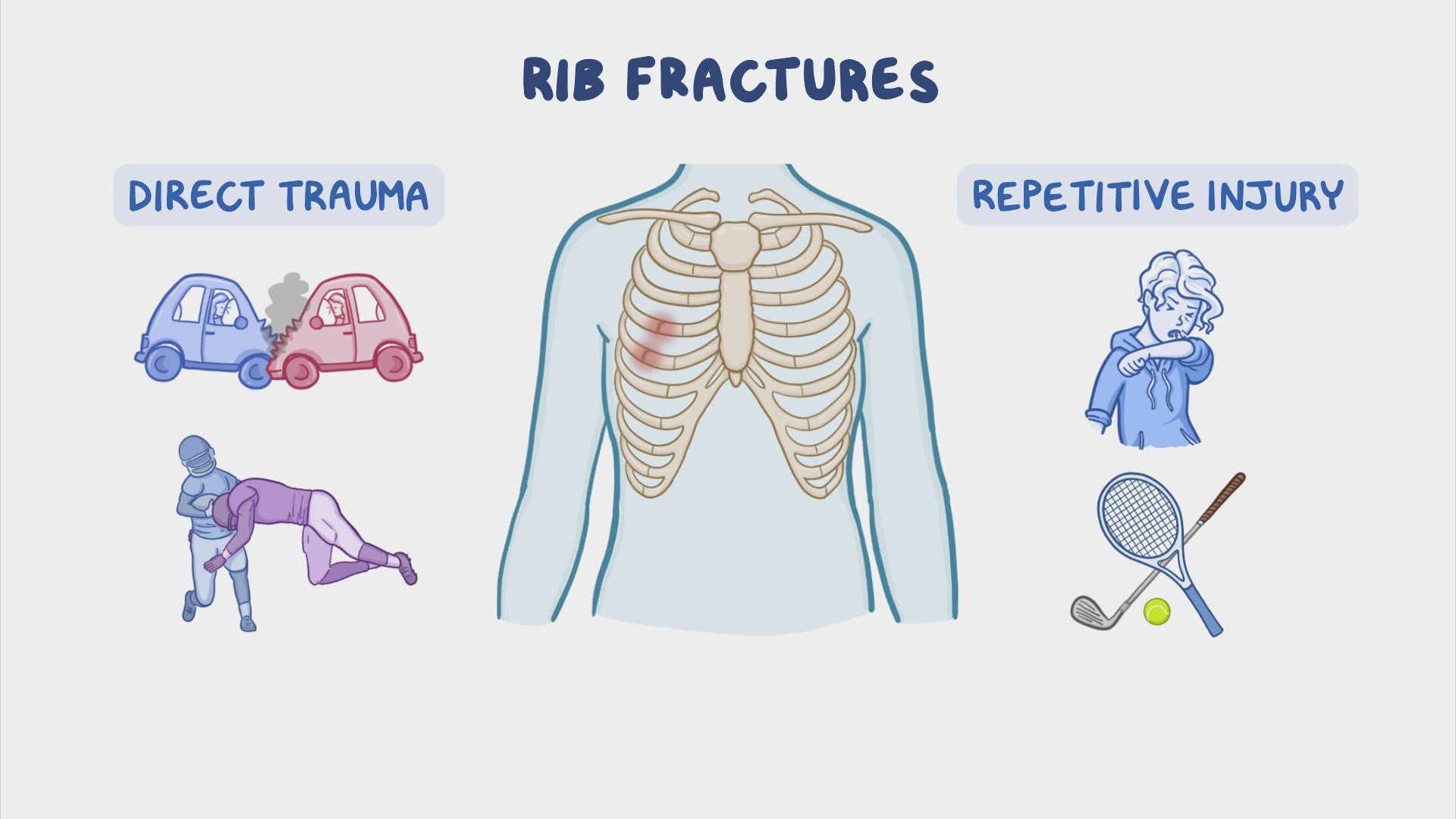 Video Rib Fracture Nursing Osmosis