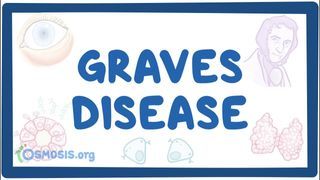 Video poster for Graves' disease