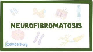 Video poster for Neurofibromatosis