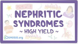 Video poster for High Yield: Nephritic syndromes