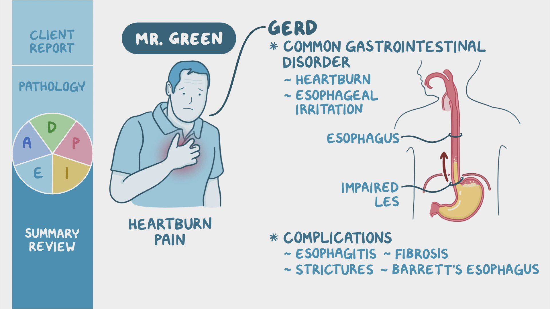 Video: Gastroesophageal reflux disease (GERD): Nursing process (ADPIE ...