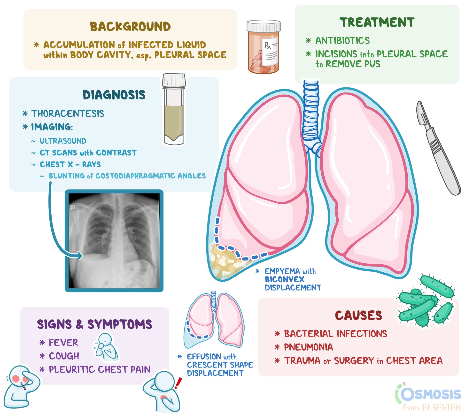 Empyema: What Is It, Causes, Treatment, and More | Osmosis