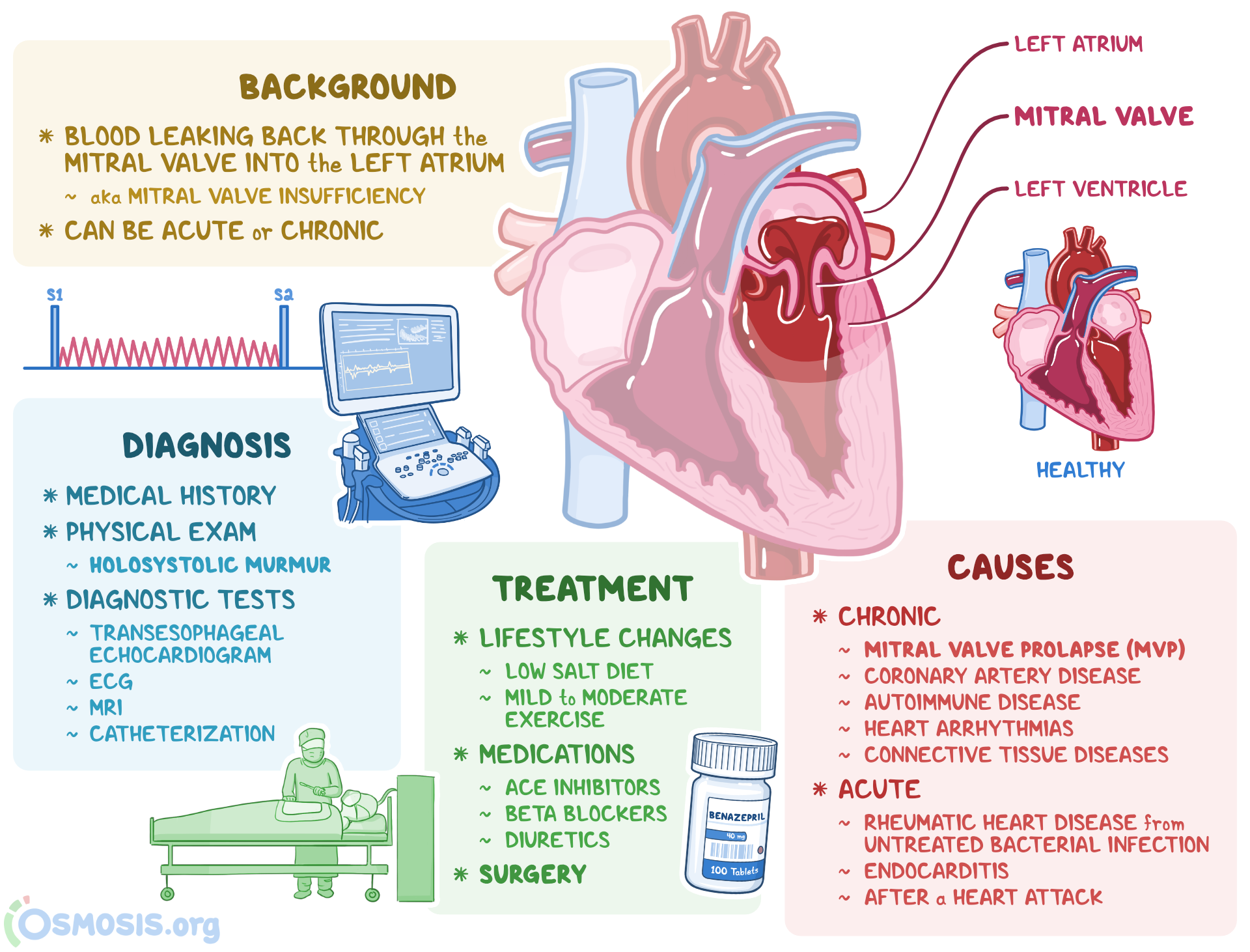 Mitral Valve Regurgitation What Is It Causes Diagnosis Treatment 