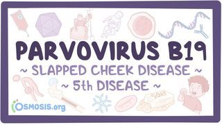 Video poster for Parvovirus B19