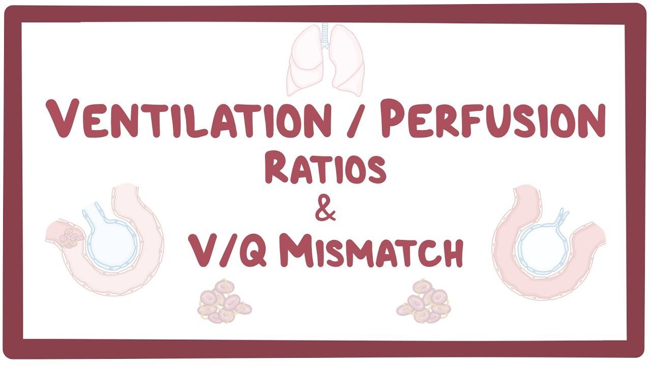 What is Ventilation Perfusion Mismatch: Causes, Symptoms & Solutions