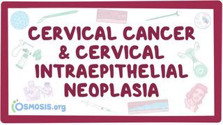 Video poster for Cervical cancer