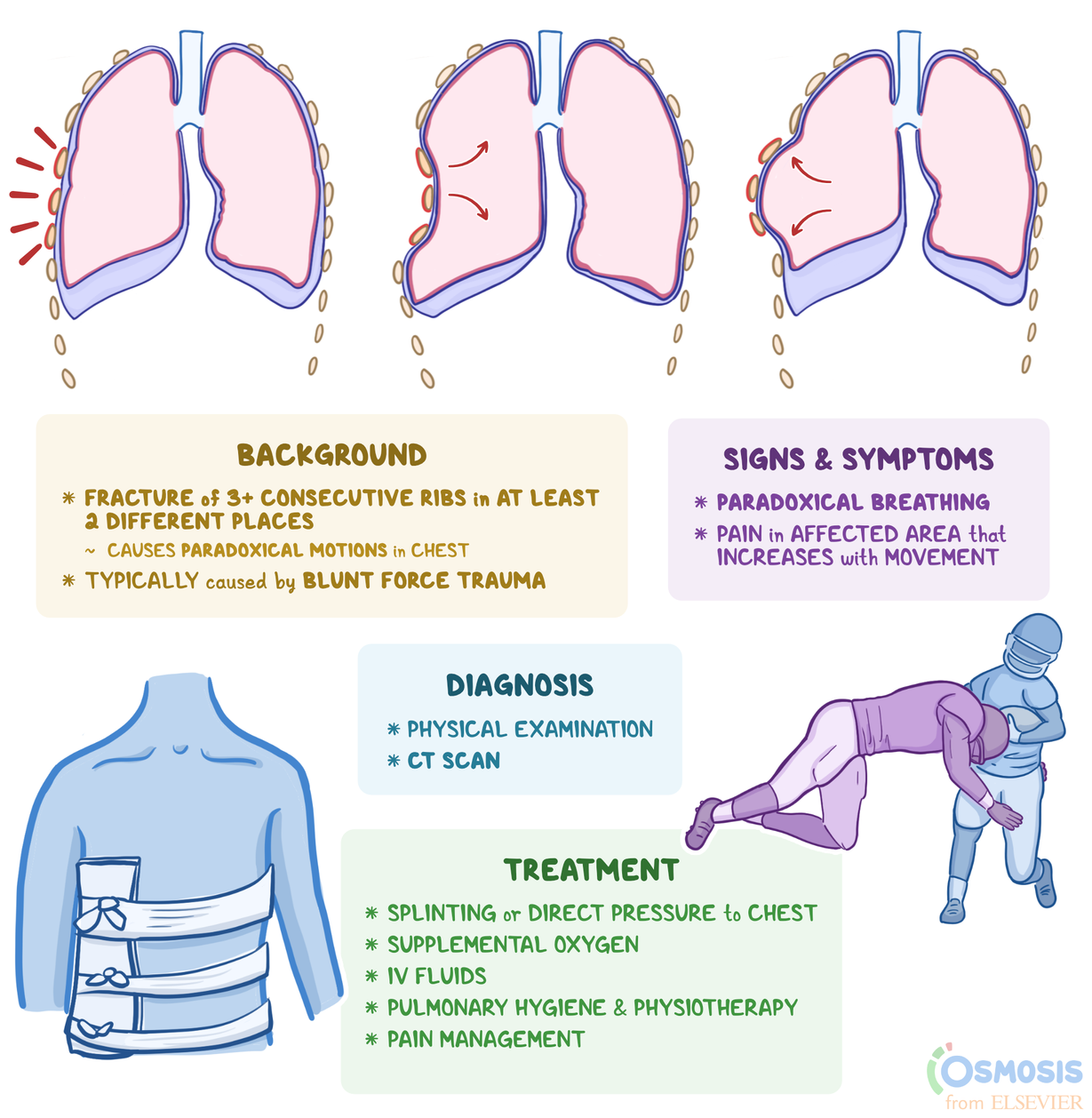 Paradoxical Breathing Symptoms Causes And Treatment WAEXX