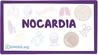 Video poster for Nocardia