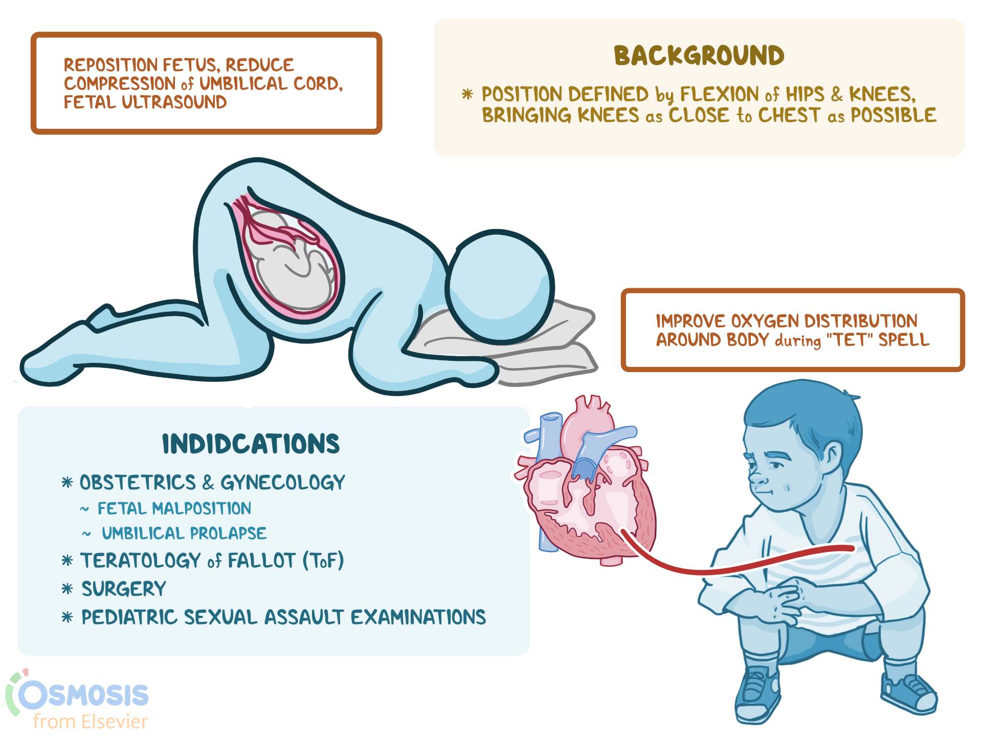 Knee Chest Position What Is It Uses And More Osmosis