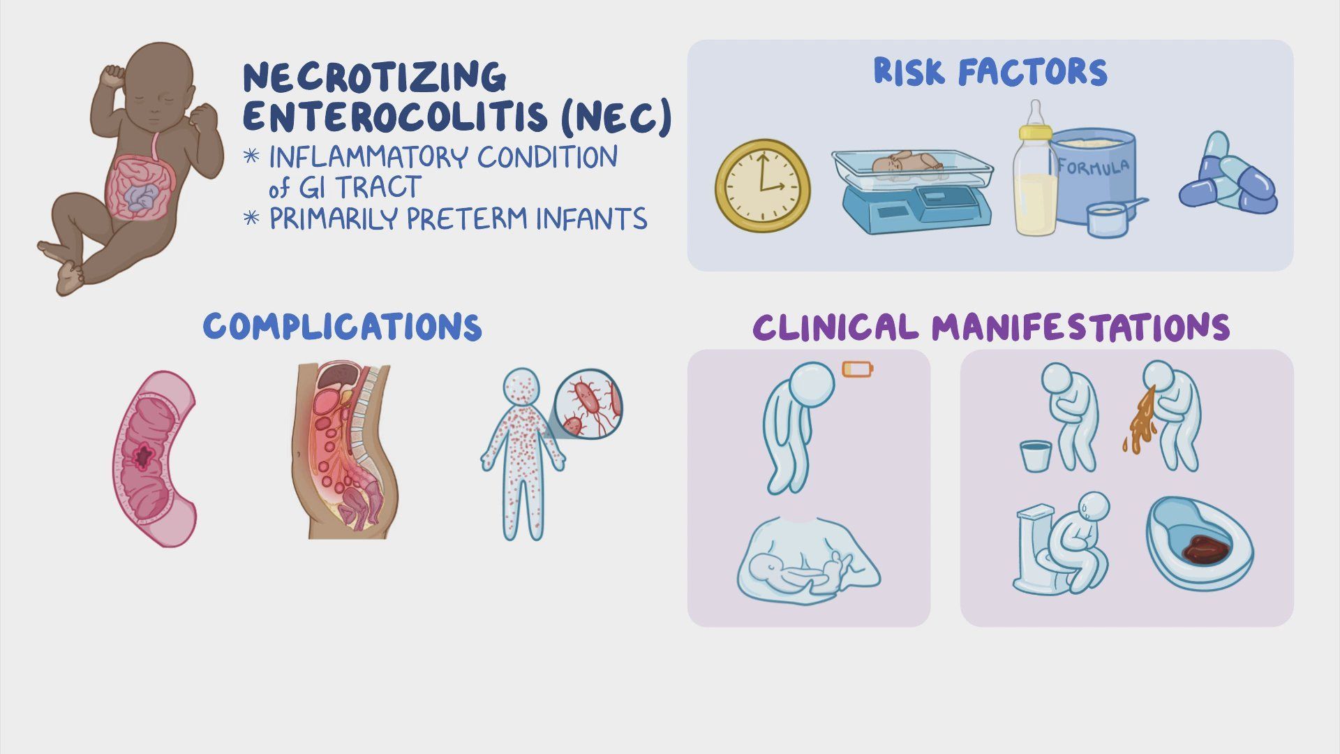 Video Necrotizing Enterocolitis Nursing Video Necrotizing Enterocolitis Nursing