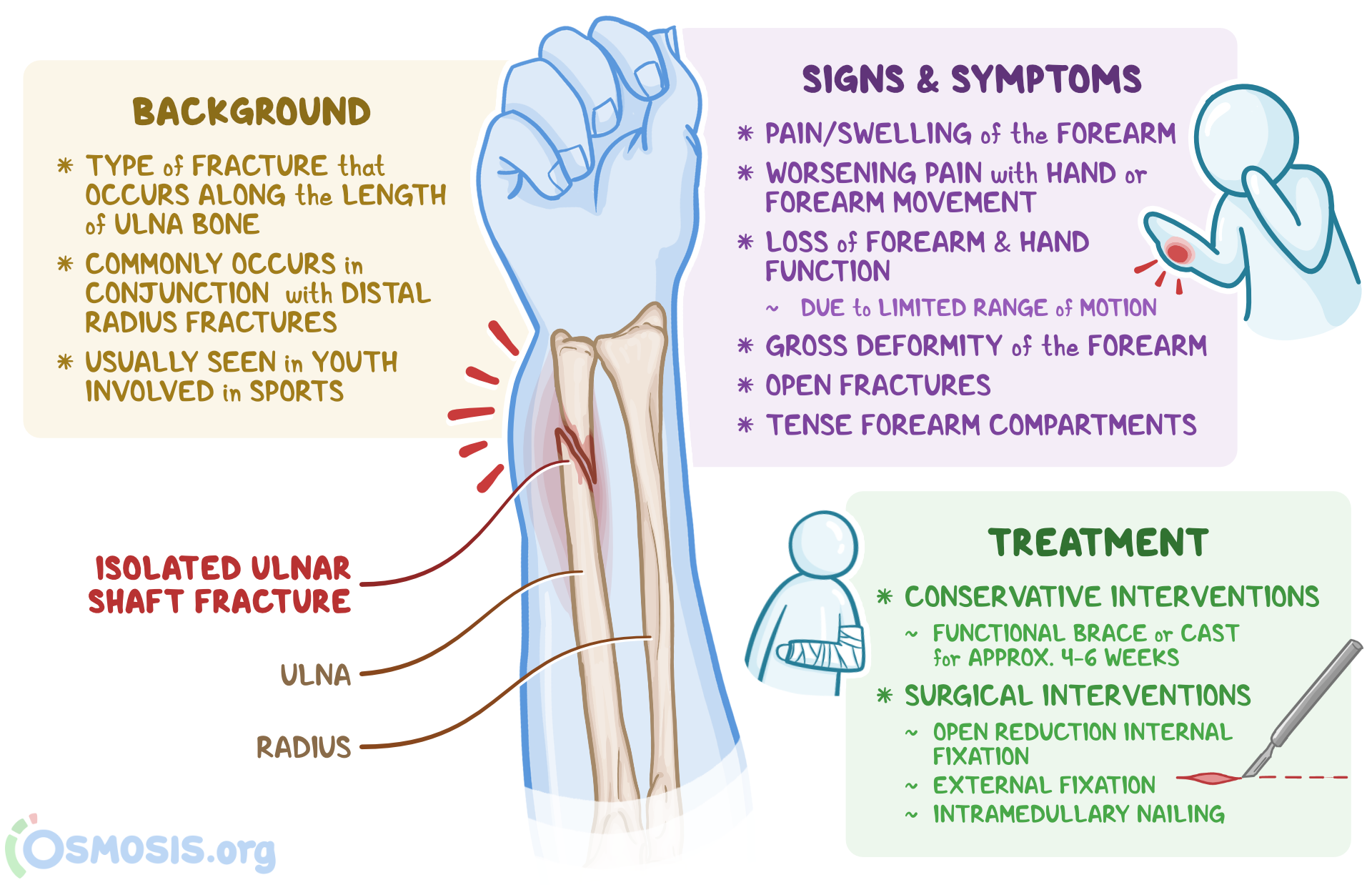 Ulna Fracture X Ray