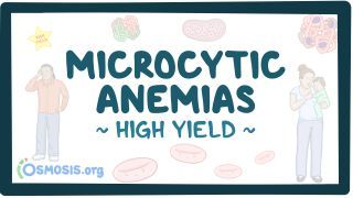 Video poster for High Yield: Microcytic anemias