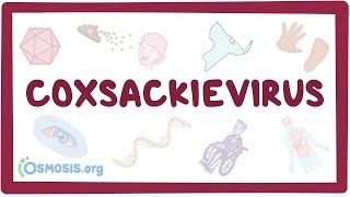 Video poster for Coxsackievirus