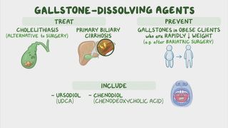glutathione to dissolve gallstones Gallstone-dissolving agents: Nursing pharmacology Buy hCG Injections Online