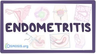 Video poster for Endometritis