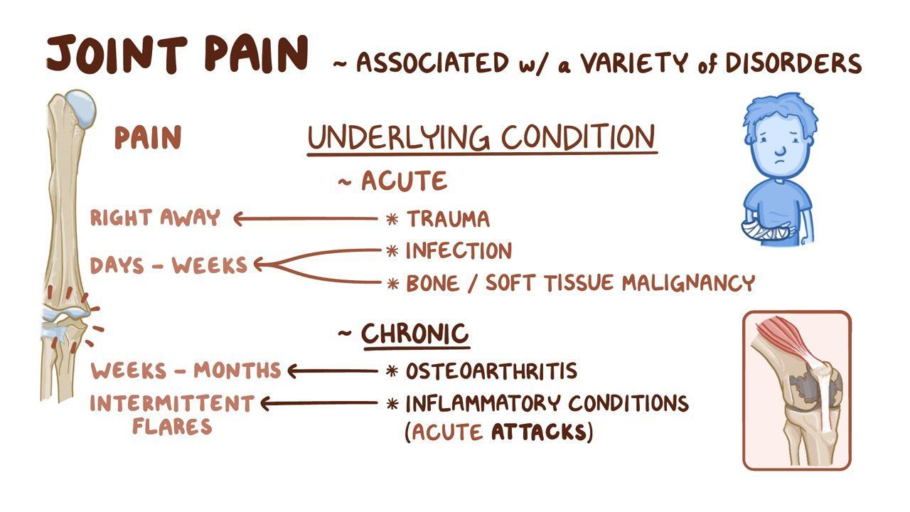 Joint pain Clinical practice Osmosis