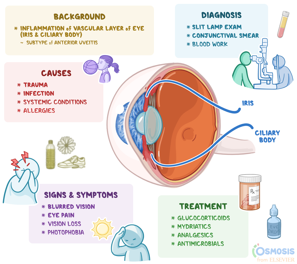 Iridocyclitis What Is It Causes Diagnosis Treatment And More Osmosis