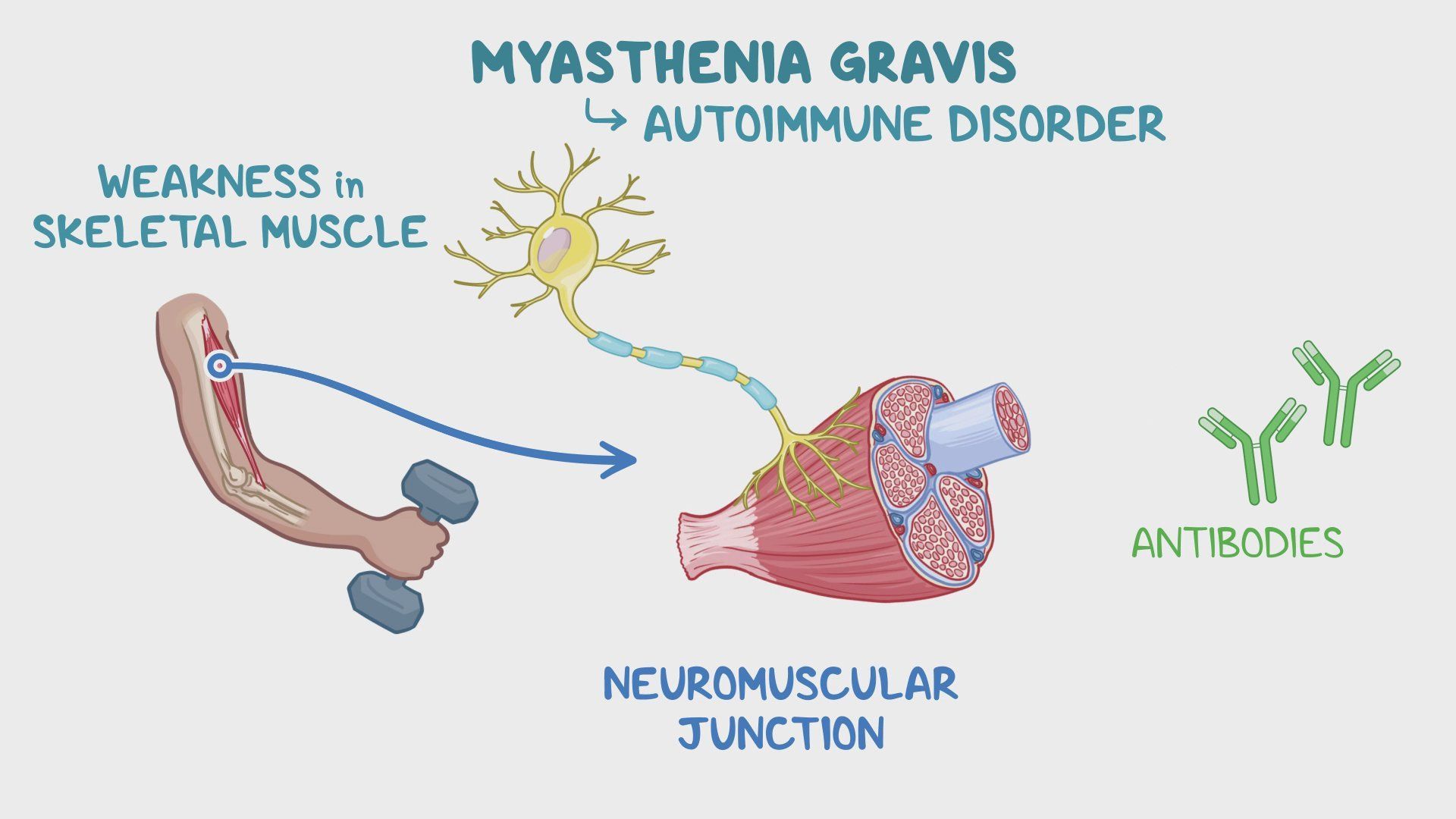 Video myasthenia gravis year of the zebra 2024 osmosis