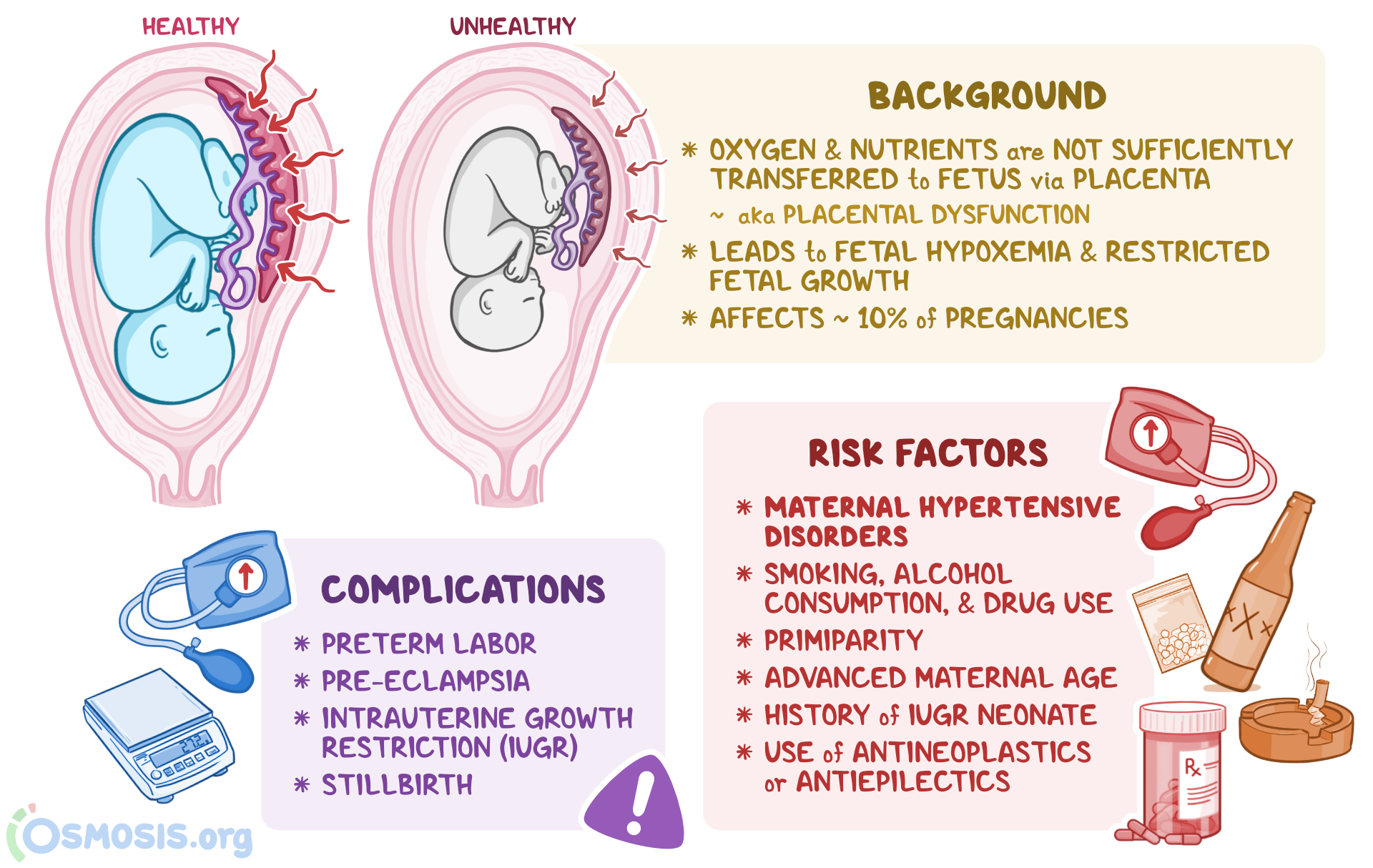 Placental Insufficiency What Is It Causes Symptoms Treatment Osmosis