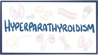 Video poster for Hyperparathyroidism