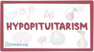 Video poster for Hypopituitarism