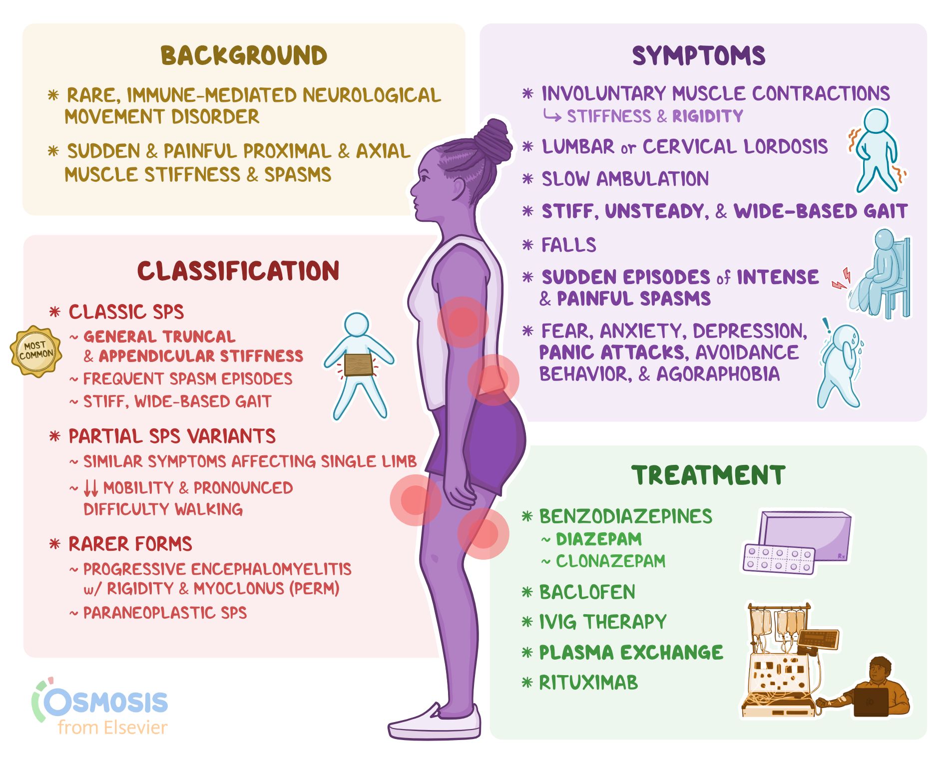 Stiff Person Syndrome What Is It Causes Diagnosis And More Osmosis
