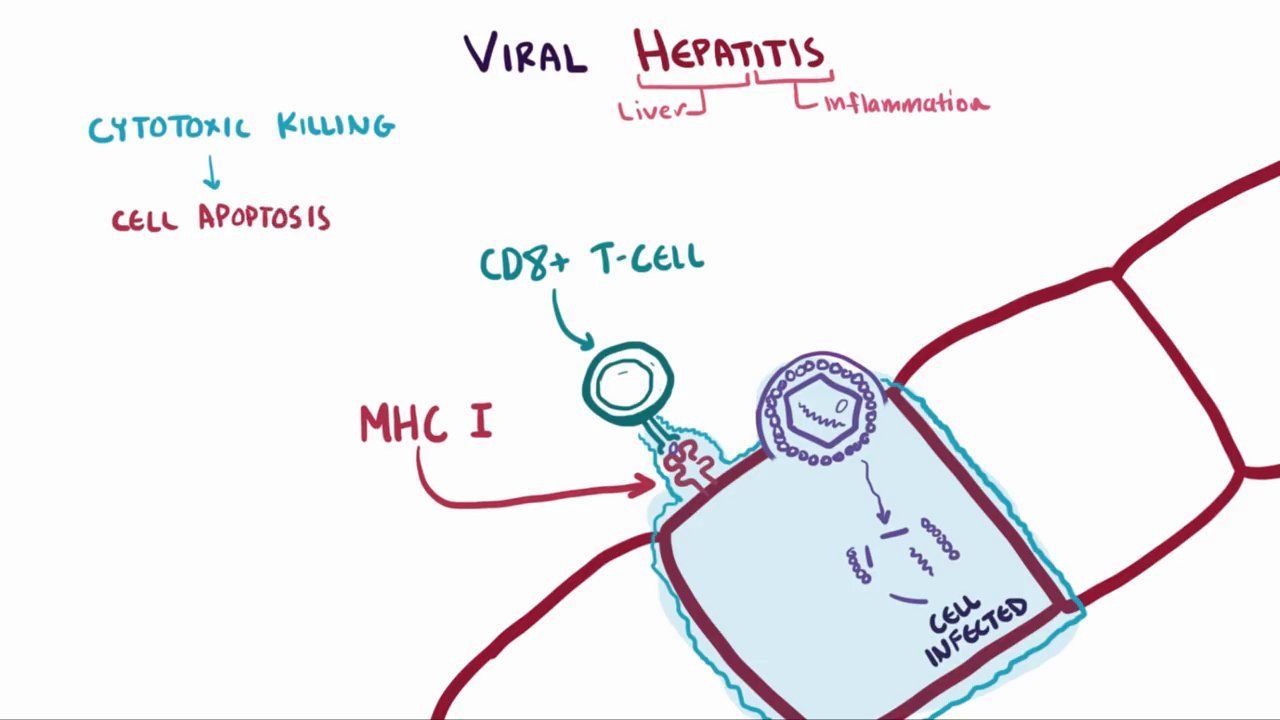 Hepatitis