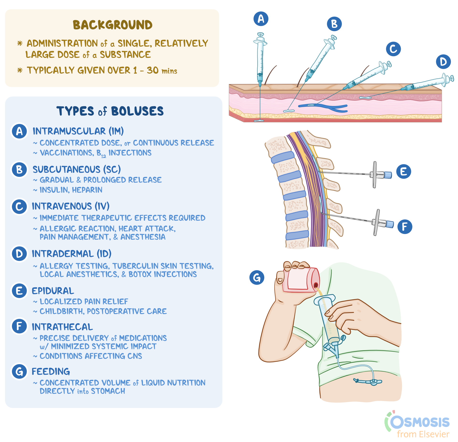 Bolus: What Is It, Different Types, Indications, and More | Osmosis