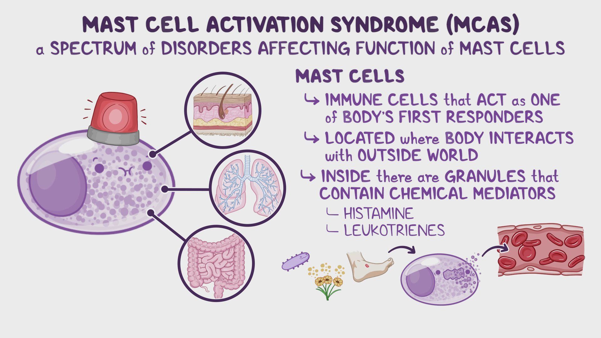 Mast cell activation syndrome (MCAS): Year of the Zebra 2026