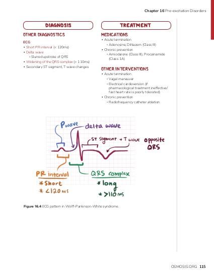 Wolff-Parkinson-White Syndrome