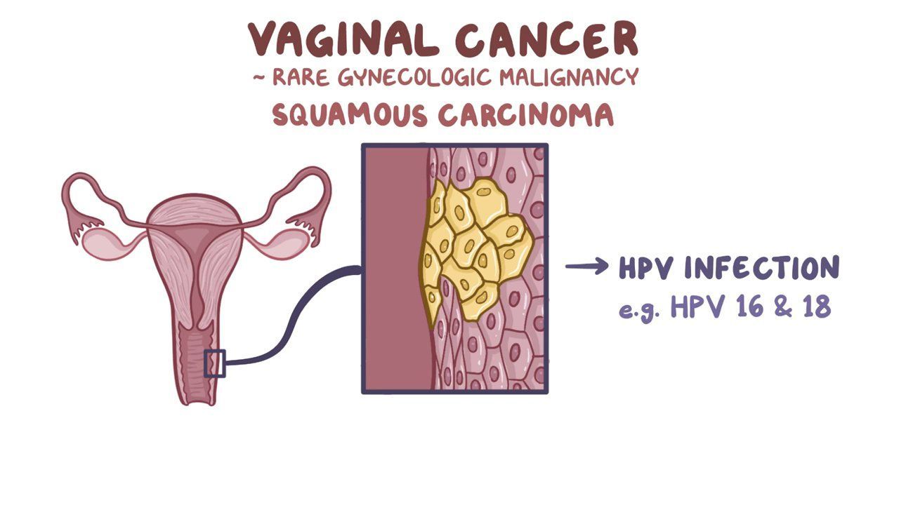 Yigit ozining etuk qoshnisini eshakda sikdi