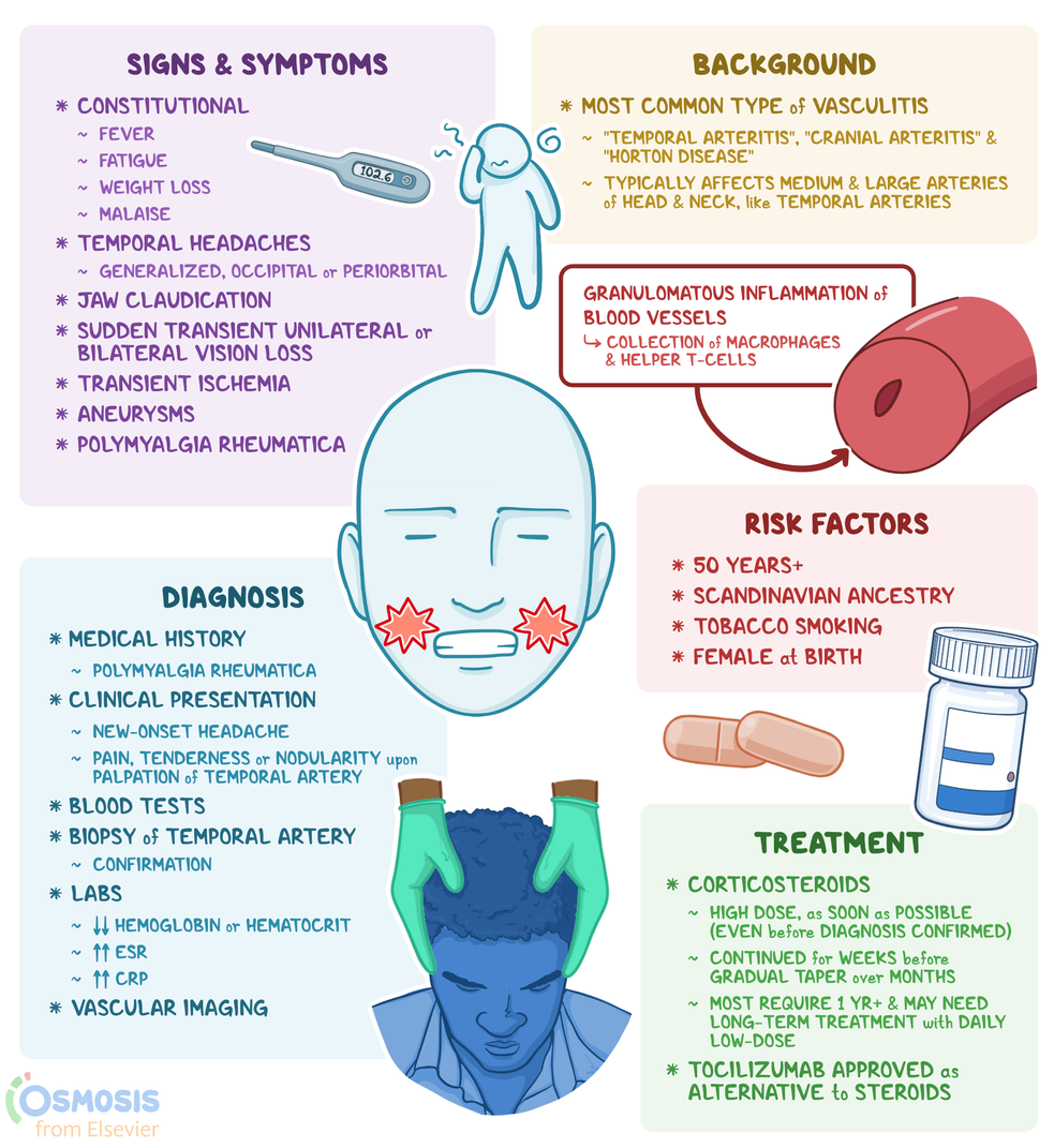 Giant Cell Arteritis What Is It Causes Diagnosis And More Osmosis