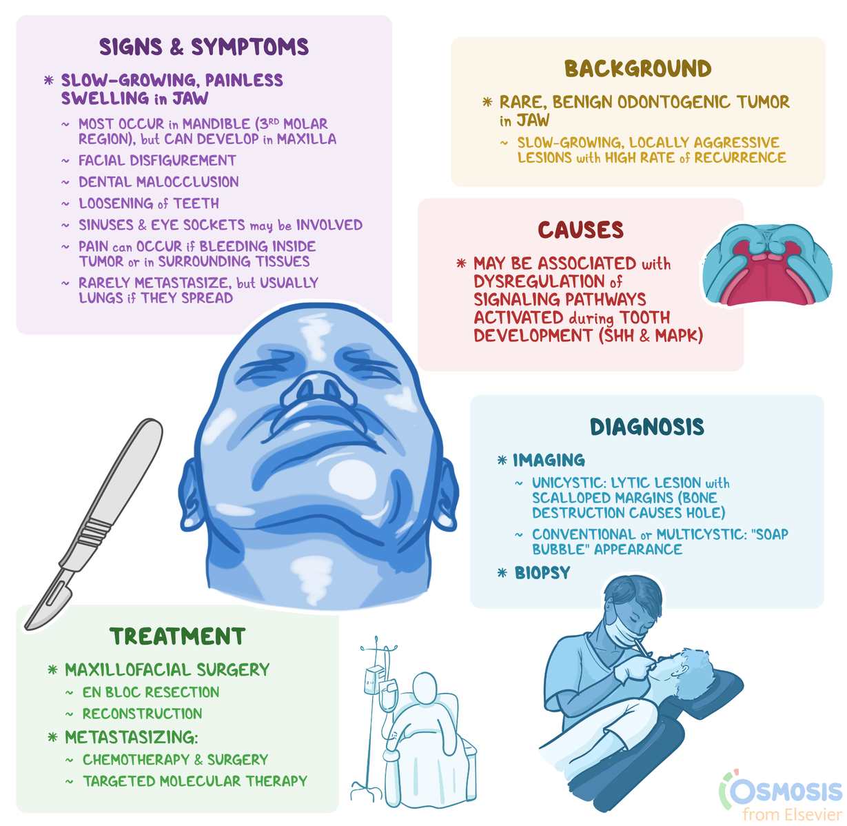 Ameloblastoma What Is It, Causes, Signs and Symptoms, and More Osmosis