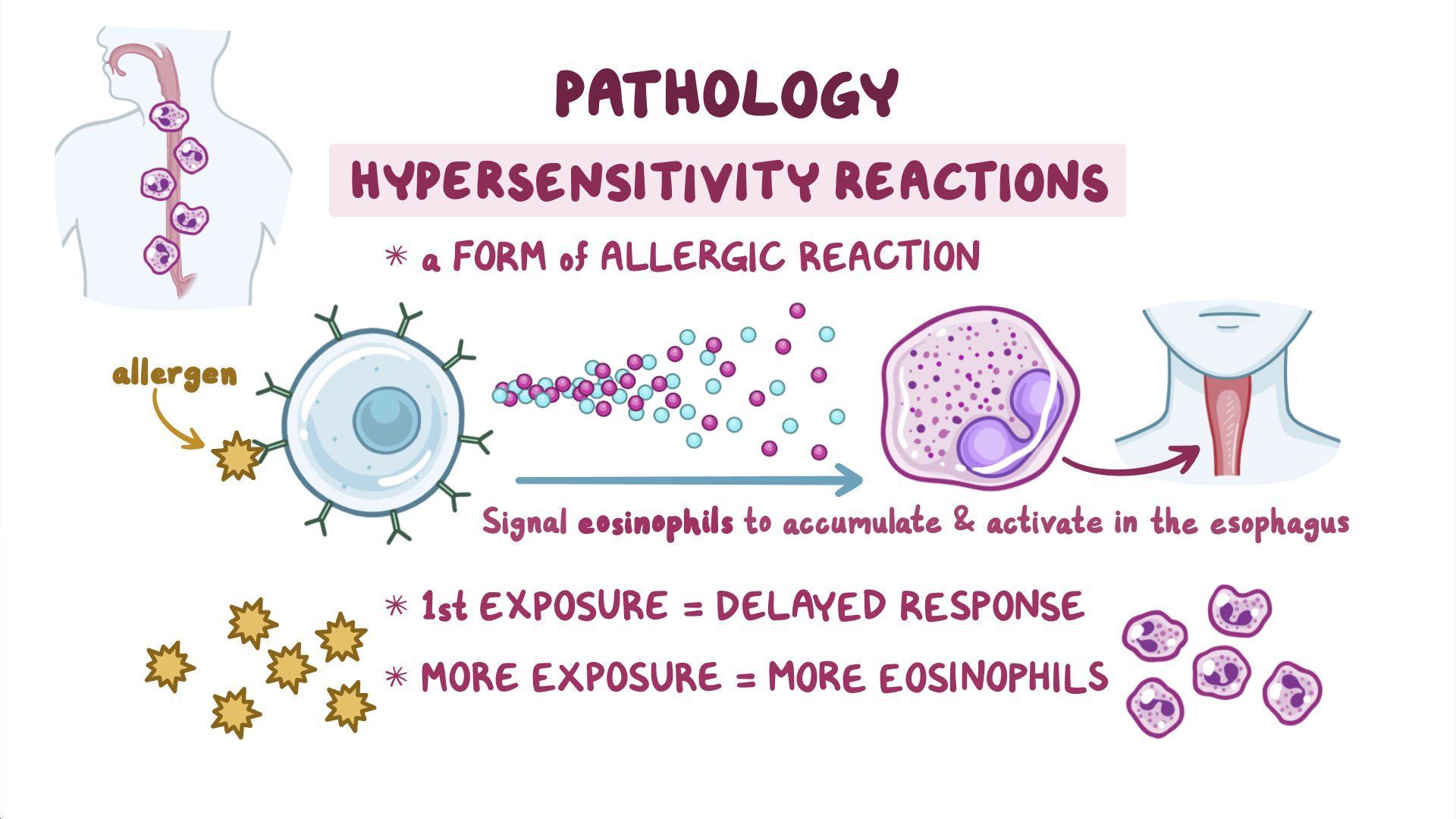 Video: Eosinophilic esophagitis (NORD) | Osmosis