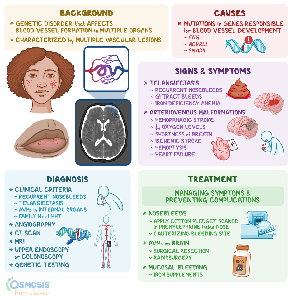 Hereditary Hemorrhagic Telangiectasia: What Is It, Causes | Osmosis