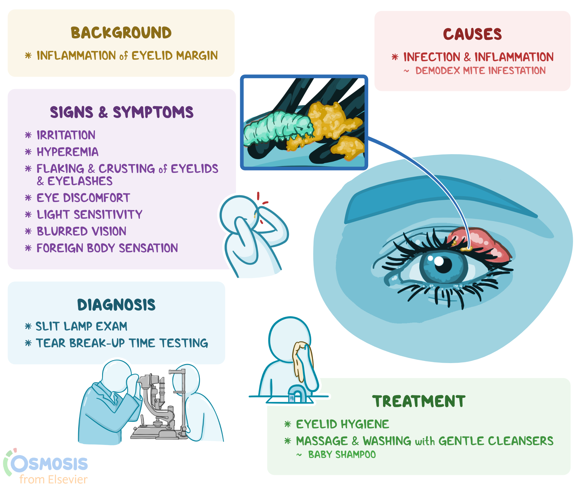 Blepharitis Treatment Drops