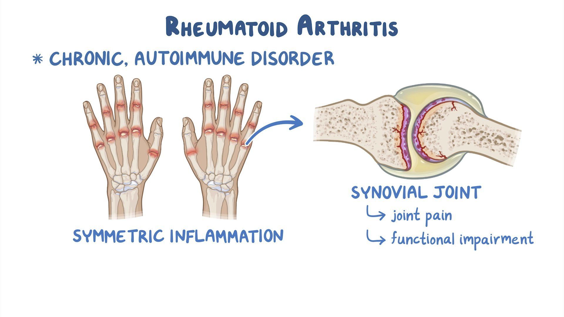 Video rheumatoid arthritis clinical sciences