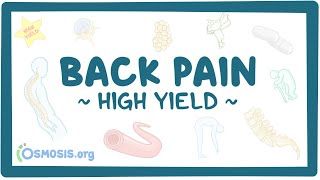 Video poster for High Yield: Back pain