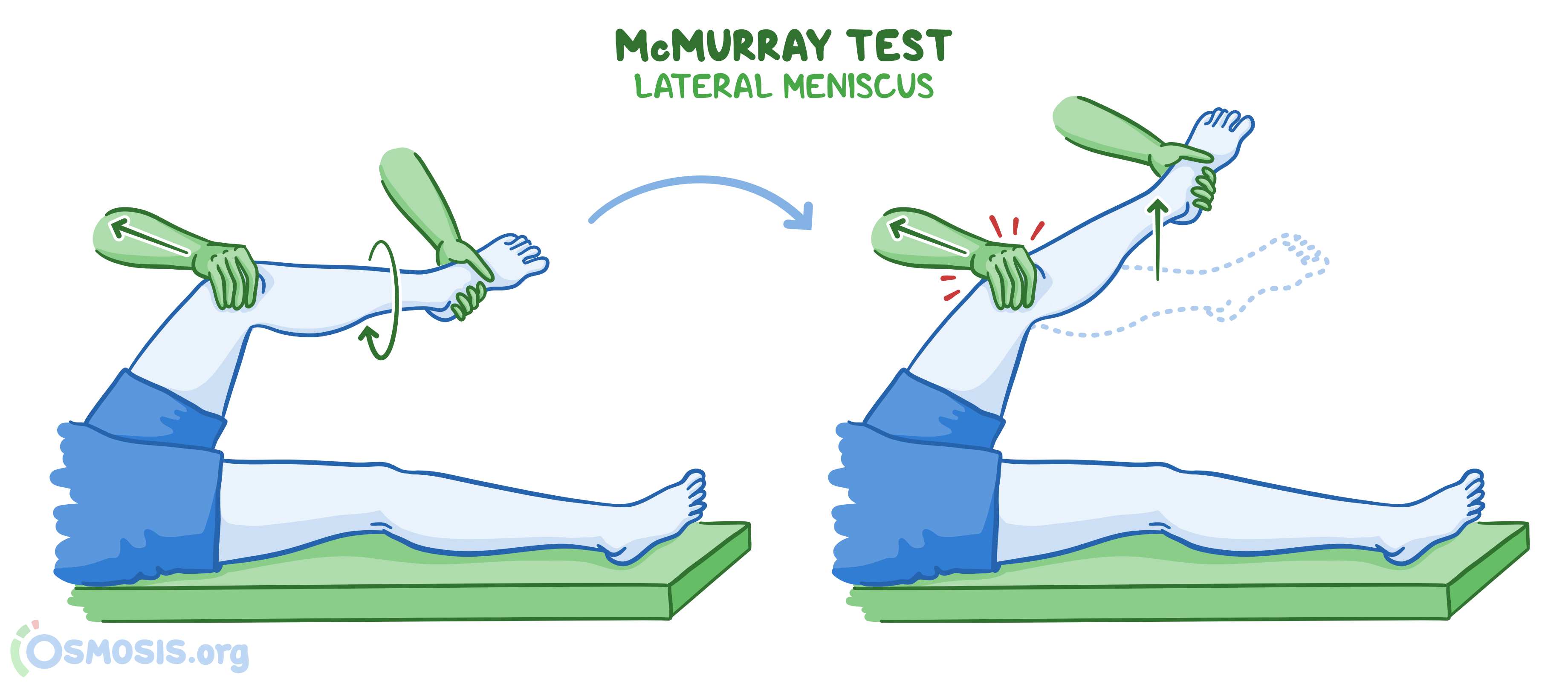 Special Tests For The Lower Limb Osmosis