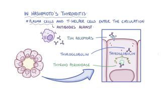 glutathion hashimoto thyroiditis NonPack