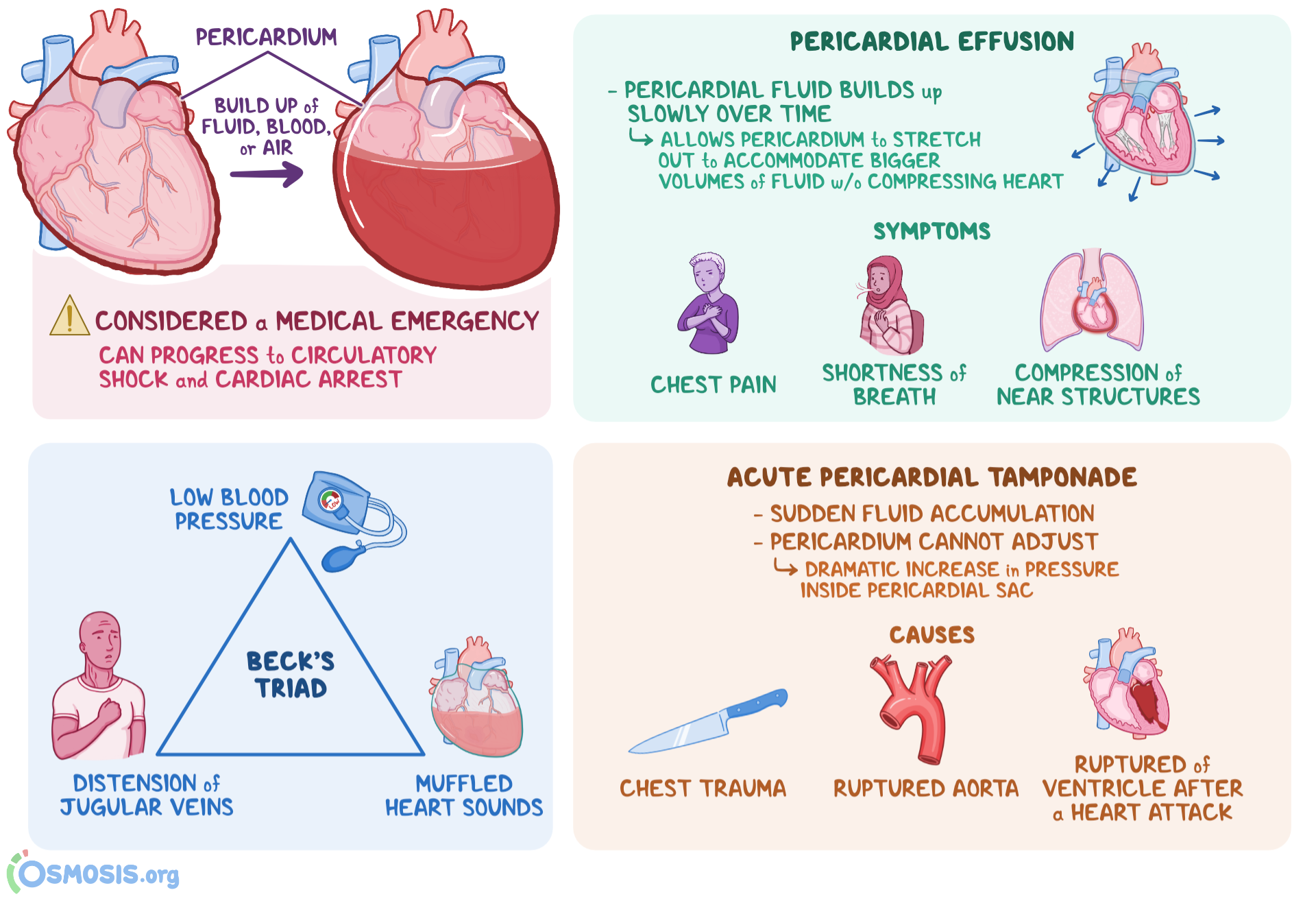 Pericardial Tamponade Signs And Symptoms