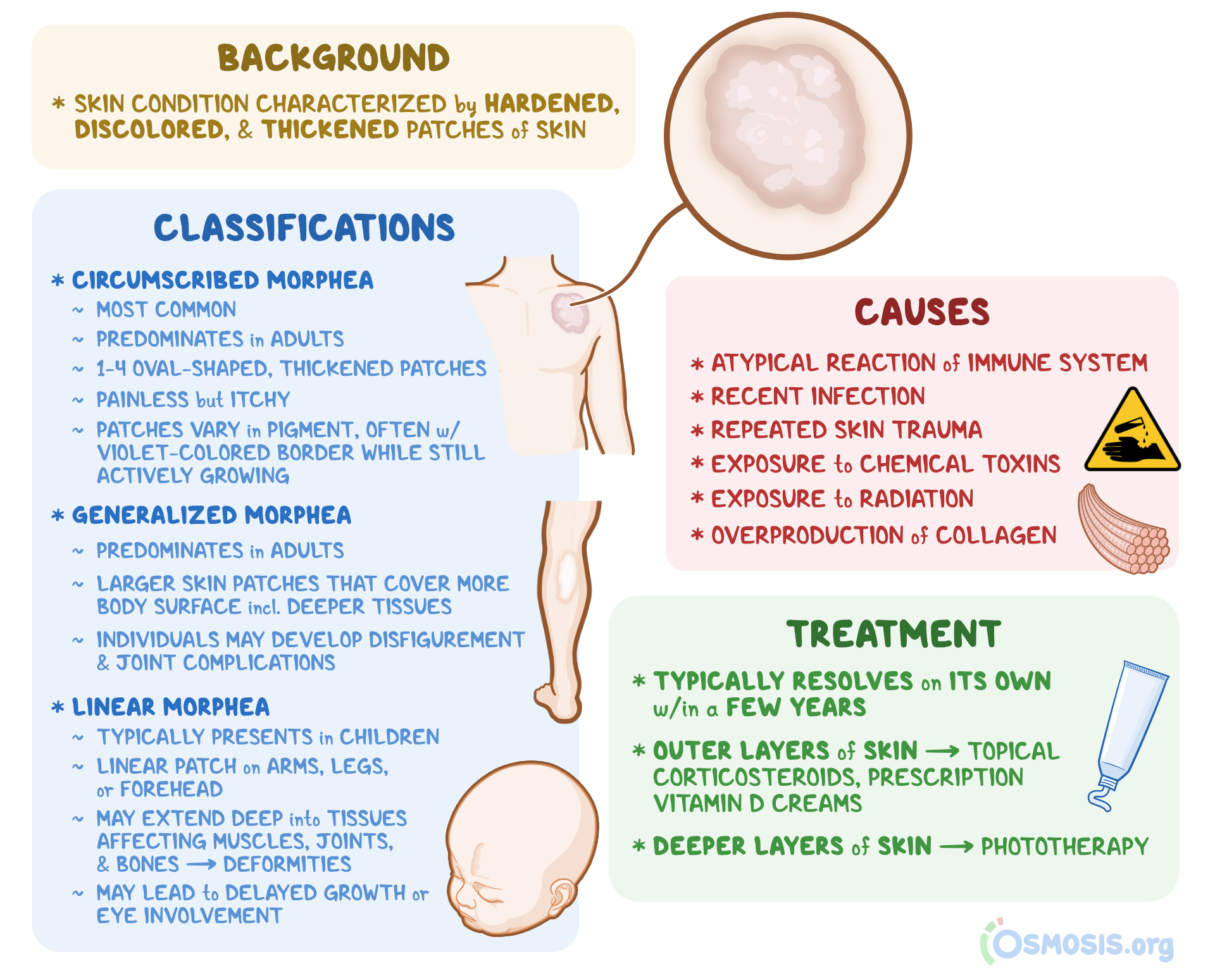 Morphea Scleroderma What Is It Causes Treatment And More Osmosis