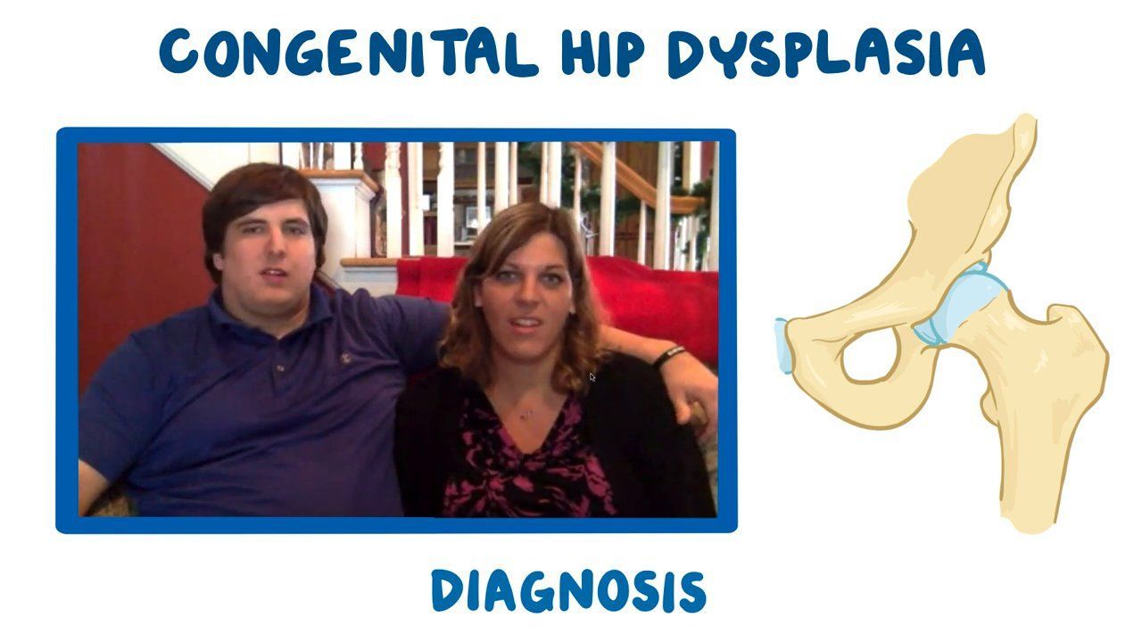 Image showcasing Video: Patients Perspective: Congenital Hip Dysplasia | Osmosis